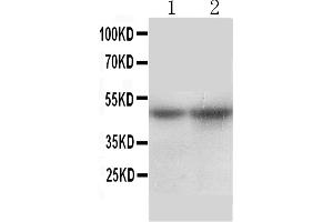 Anti-SLC10A1 antibody, Western blottingAll lanes: Anti SLC10A1  at 0. (SLC10A1 anticorps  (Middle Region))