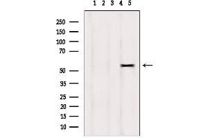 Western blot analysis of extracts from hepg2, using DPP4 antibody. (DPP4 anticorps  (C-Term))
