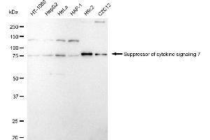 Western blotting analysis using Suppressor of cytokine signaling 7 antibody (ABIN7800466).