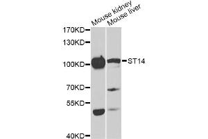 Western blot analysis of extracts of various cell lines, using ST14 antibody (ABIN6293606) at 1:1000 dilution. (ST14 anticorps)