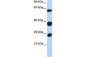 WB Suggested Anti-SNRPB  Antibody Titration: 0.