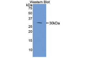 Western Blotting (WB) image for anti-Microtubule-Associated Protein 4 (MAP4) (AA 2-250) antibody (ABIN3206867) (MAP4 anticorps  (AA 2-250))