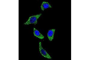 Confocal immunofluorescent analysis of TNFRSF1A Antibody (N-term) (ABIN655208 and ABIN2844822) with U-251MG cell followed by Alexa Fluor 488-conjugated goat anti-rabbit lgG (green). (TNFRSF1A anticorps  (N-Term))
