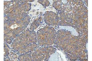 IHC analysis of RPL32 using anti-RPL32 antibody (ABIN7602916). (RPL32 anticorps  (C-Term))