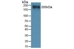 Western blot analysis of Mouse Heart Tissue. (Versican anticorps  (AA 3058-3299))