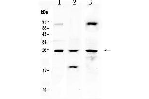 Western blot analysis of TIMP4 using anti- TIMP4 antibody . (TIMP4 anticorps  (AA 174-224))