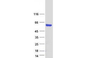 Validation with Western Blot