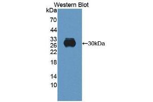 Western blot analysis of the recombinant protein. (Retbindin anticorps  (AA 32-247))