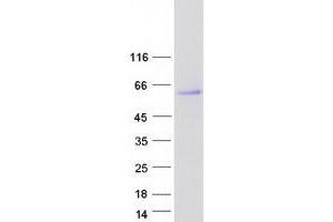 Validation with Western Blot