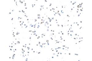 Immunocytochemistry (ICC) image for anti-CCCTC-Binding Factor (Zinc Finger Protein) (CTCF) (AA 650-700) antibody (ABIN7453967) (Recombinant CTCF anticorps  (AA 650-700))