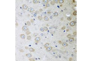 Immunohistochemistry of paraffin-embedded mouse brain using ATAD3A antibody. (ATAD3A anticorps)