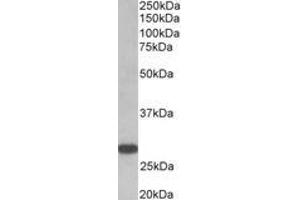 Image no. 1 for anti-Thyroid Stimulating Hormone Receptor (TSHR) (AA 101-115), (Extracellular Domain) antibody (ABIN1104855) (TSH receptor anticorps  (Extracellular Domain))