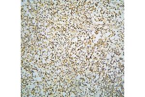 IHC analysis of R Cadherin/CDH4 using anti-R Cadherin/CDH4 antibody (ABIN6719392). (Cadherin 4 anticorps  (AA 458-641))