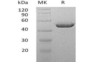 Western Blotting (WB) image for Carbonic Anhydrase IV (CA4) (AA 17-420) protein (His tag) (ABIN7320481)