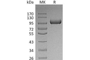 Western Blotting (WB) image for Leucine-Rich Repeats and Immunoglobulin-Like Domains 1 (Lrig1) protein (His tag) (ABIN7320807)