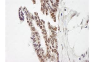 anti-Zinc Finger Protein 261 (ZMYM3) (AA 250-300) antibody
