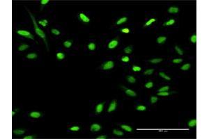 Immunofluorescence of purified MaxPab antibody to MCM4 on HeLa cell. (MCM4 anticorps  (AA 1-863))