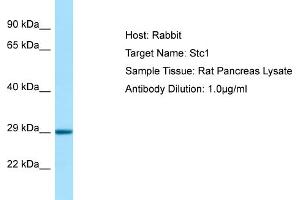 WB Suggested Anti-Stc1 Antibody   Titration: 1. (Stanniocalcin 1 anticorps  (C-Term))