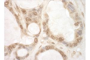Immunohistochemistry (IHC) image for anti-Eukaryotic Translation Initiation Factor 2B, Subunit 5 Epsilon, 82kDa (EIF2B5) (AA 550-600) antibody (ABIN7448544)