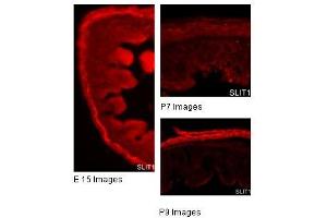 SLIT1 antibody used at a concentration of 2 and 10 ug/ml to detect gut tissue. (SLIT1 anticorps)