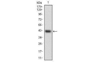 Image no. 2 for anti-Heat Shock Transcription Factor 4 (HSF4) antibody (ABIN1498728)