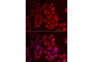Immunofluorescence analysis of U2OS cells using XCL1 antibody (ABIN5973809). (XCL1 anticorps)