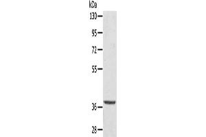 Gel: 8 % SDS-PAGE, Lysate: 40 μg, Lane: Hepg2 cells, Primary antibody: ABIN7192738(TBC1D21 Antibody) at dilution 1/300, Secondary antibody: Goat anti rabbit IgG at 1/8000 dilution, Exposure time: 10 seconds (TBC1D21 anticorps)