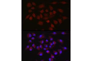 Immunofluorescence analysis of A-549 cells using cI Rabbit pAb (ABIN1678920, ABIN3015349, ABIN3015350 and ABIN6213998) at dilution of 1:50 (40x lens).