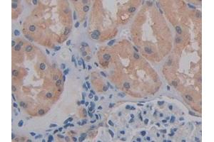 Detection of CD147 in Human Kidney Tissue using Polyclonal Antibody to Cluster Of Differentiation 147 (CD147)