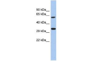 WB Suggested Anti-FAM26A Antibody Titration: 0. (CALHM3 anticorps  (C-Term))