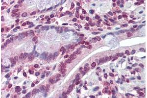 Human Small Intestine: Formalin-Fixed, Paraffin-Embedded (FFPE)
