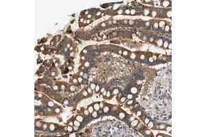 Immunohistochemical staining of human colon with WDR31 polyclonal antibody  strong cytoplasmic positivity in glandular cells at 1:200-1:500 dilution. (WDR31 anticorps)