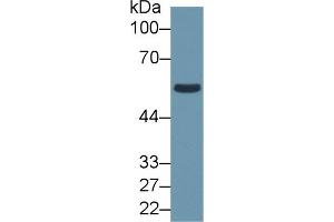 Detection of ALDH1B1 in Human HepG2 cell lysate using Polyclonal Antibody to Aldehyde Dehydrogenase 1 Family, Member B1 (ALDH1B1)