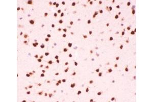 IHC testing of FFPE mouse brain tissue with ATF2 antibody at 1ug/ml. (ATF2 anticorps  (AA 93-450))