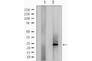 Western blot analysis of extracts from mouse lung, using RANBP1 Antibody.