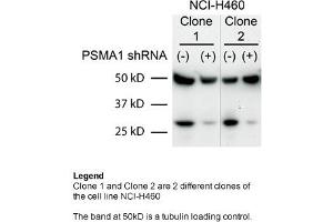 Sample Type: Human non-small cell lung cancer (NCI-460)Primary Dilution: 1:2000Secondary Dilution: 1:300050kDa band is a tubulin loading control band PSMA1 is strongly supported by BioGPS gene expression data to be expressed in Human NCI460 cells (PSMA1 anticorps  (C-Term))