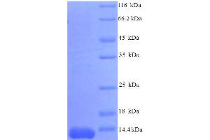 SDS-PAGE (SDS) image for Chemokine (C-C Motif) Ligand 7 (CCL7) (AA 28-97), (partial) protein (His tag) (ABIN5712654)