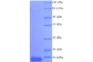 SDS-PAGE (SDS) image for Chemokine (C-C Motif) Ligand 7 (CCL7) (AA 28-97), (partial) protein (His tag) (ABIN5712654) (CCL7 Protein (AA 28-97, partial) (His tag))
