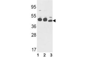 Western blot analysis of Cytokeratin-18 antibody and (1) K562, (2) NCI-H460, and (3) mouse stomach lysate.