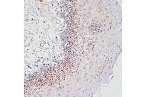 Immunohistochemistry of paraffin-embedded Human tonsil using Desmoplakin antibody (ABIN6134106, ABIN6139838, ABIN6139840 and ABIN6223548) at dilution of 1:100 (40x lens). (Desmoplakin anticorps  (AA 1-100))