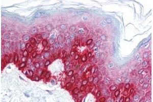 Human Skin (formalin-fixed, paraffin-embedded) stained with FOXA3 antibody ABIN214752 at 5 ug/ml followed by biotinylated goat anti-rabbit IgG secondary antibody ABIN481713, alkaline phosphatase-streptavidin and chromogen.