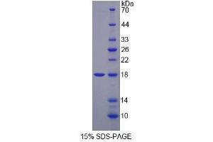 SDS-PAGE analysis of Mouse MARS Protein. (MARS Protéine)