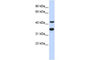 WB Suggested Anti-POLD2 Antibody Titration:  0. (POLD2 anticorps  (N-Term))