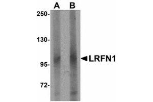 Image no. 1 for anti-Leucine Rich Repeat and Fibronectin Type III Domain Containing 1 (LRFN1) (C-Term) antibody (ABIN478048) (LRFN1 anticorps  (C-Term))