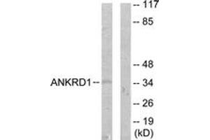 Western blot analysis of extracts from COLO205 cells, using ANKRD1 Antibody.