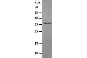 Western Blotting (WB) image for Glucosidase, Beta, Acid (GBA) (AA 362-512) protein (His-IF2DI Tag) (ABIN7123107) (GBA Protein (AA 362-512) (His-IF2DI Tag))