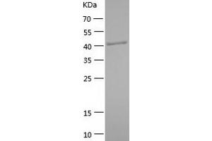 Western Blotting (WB) image for Interferon Regulatory Factor 3 (IRF3) (AA 2-427) protein (His-IF2DI Tag) (ABIN7123496)