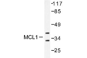 Image no. 1 for anti-Induced Myeloid Leukemia Cell Differentiation Protein Mcl-1 (MCL1) antibody (ABIN265513) (MCL-1 anticorps)