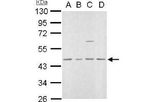 WB Image MVD antibody detects MVD protein by Western blot analysis. (MVD anticorps  (Center))