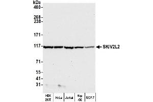 Western Blotting (WB) image for anti-Superkiller Viralicidic Activity 2-Like 2 (SKIV2L2) (AA 100-150) antibody (ABIN7449416) (MTR4 anticorps  (AA 100-150))